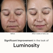 Load image into Gallery viewer, INTENSE Serum