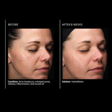 Load image into Gallery viewer, HydraMatte